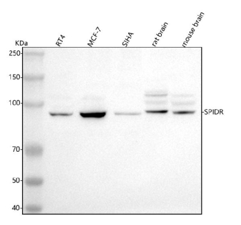 Western blot analysis of SPIDR using anti-SPIDR antibody. Lane 1: human RT4 whole cell lysates, Lane 2: human MCF-7 whole cell lysates, Lane 3: human SIHA whole cell lysates, Lane 4: rat brain tissue lysates, Lane 5: mouse brain tissue lysates. After electrophoresis, proteins were transferred to a nitrocellulose membrane at 150 mA for 50-90 minutes. Blocked the membrane with 5% non-fat milk/TBS for 1.5 hour at RT. The membrane was incubated with rabbit anti-SPIDR antibody at 0.5 ug/ml overnight at 4oC, then washed with TBS-0.1%Tween 3 times with 5 minutes each and probed with a goat anti-rabbit IgG-HRP secondary antibody at a dilution of 1:5000 for 1.5 hour at RT. The signal was developed using enhanced chemiluminescent. A predominant band is observed at ~95 kDa with additional higher-migrating species, particularly in rat and mouse brain, consistent with reported phosphorylation and other post-translationally modified forms relative to the ~100 kDa calculated mass.