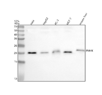 Western blot analysis of PMVK using anti-PMVK antibody. Lane 1: human Hela whole cell lysates, Lane 2: human HepG2 whole cell lysates, Lane 3: human PC-3 whole cell lysates, Lane 4: human MCF-7 whole cell lysates, Lane 5: mouse liver tissue lysates. After electrophoresis, proteins were transferred to a nitrocellulose membrane at 150 mA for 50-90 minutes. Blocked the membrane with 5% non-fat milk/TBS for 1.5 hour at RT. The membrane was incubated with rabbit anti-PMVK antibody at 0.5 ug/ml overnight at 4oC, then washed with TBS-0.1%Tween 3 times with 5 minutes each and probed with a goat anti-rabbit IgG-HRP secondary antibody at a dilution of 1:5000 for 1.5 hour at RT. The signal was developed using enhanced chemiluminescent. The expected molecular weight of PMVK is ~22 kDa.