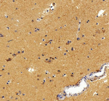 Immunohistochemical staining of Aldolase C/ALDOC using anti-ALDOC antibody. Aldolase C/ALDOC was detected in a paraffin-embedded section of human brain tissue. Heat mediated antigen retrieval was performed in EDTA buffer (pH 8.0, epitope retrieval solution). The tissue section was blocked with 10% goat serum. The tissue section was then incubated with 2 ug/ml rabbit anti-ALDOC antibody overnight at 4oC. Peroxidase Conjugated Goat Anti-rabbit IgG was used as secondary antibody and incubated for 30 minutes at 37oC. The tissue section was developed using an HRP secondary and DAB substrate.