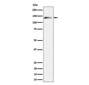 Western blot analysis of Delta 2 Catenin expression in mouse brain cell lysate using CTNND2 antibody. Predicted molecular weight ~133 kDa.