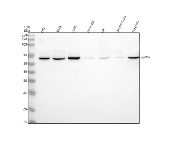 Western blot analysis of GLMN using anti-GLMN antibody. Lane 1: human HEL whole cell lysates, Lane 2: human SiHa whole cell lysates, Lane 3: human 293T whole cell lysates, Lane 4: rat brain tissue lysates, Lane 5: rat C6 whole cell lysates, Lane 6: mouse brain tissue lysates, Lane 7: mouse NIH/3T3 whole cell lysates. After electrophoresis, proteins were transferred to a nitrocellulose membrane at 150 mA for 50-90 minutes. Blocked the membrane with 5% non-fat milk/TBS for 1.5 hour at RT. The membrane was incubated with rabbit anti-GLMN antibody at 0.5 ug/ml overnight at 4oC, then washed with TBS-0.1%Tween 3 times with 5 minutes each and probed with a goat anti-rabbit IgG-HRP secondary antibody at a dilution of 1:5000 for 1.5 hour at RT. The signal was developed using enhanced chemiluminescent. A specific band was detected for GLMN at approximately 68 kDa. The expected molecular weight of GLMN is ~68 kDa.