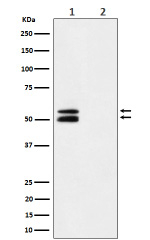 Phospho-CaMKII alpha (pThr286) western blot of mouse brain using Phospho-CaMKII alpha (pT286) antibody. Lane 1, strong ~50/55 kDa doublet consistent with different phosphorylation states of CaMKII alpha; lane 2, lambda phosphatase treatment abolishes the signal, confirming phospho-specificity.