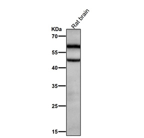 Rat brain tissue lysate tested with the Phospho-CaMKII alpha (pT286) antibody at 1:2000 dilution for 1 hour at room temperature.