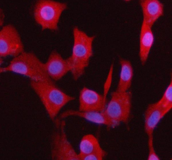 Immunofluorescent staining of BCCIP using anti-BCCIP antibody. BCCIP was detected in an immunocytochemical section of cells. Enzyme antigen retrieval was performed using IHC enzyme antigen retrieval reagent for 15 mins. The cells were blocked with 10% goat serum. And then incubated with 5 ug/ml rabbit anti-BCCIP antibody overnight at 4oC. Cy3 Conjugated Goat Anti-Rabbit IgG was used as secondary antibody at 1:500 dilution and incubated for 30 minutes at 37oC. The section was counterstained with DAPI nuclear stain (blue). Visualize using a fluorescence microscope and filter sets appropriate for the label used.
