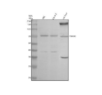 Western blot analysis of Twinkle/TWNK using anti-TWNK antibody. Electrophoresis was performed on a 10% SDS-PAGE gel at 80V (Stacking gel) / 120V (Resolving gel) for 2 hours. Lane 1: human HEL whole cell lysates, Lane 2: human Caco-2 whole cell lysates, Lane 3: rat liver tissue lysates. After electrophoresis, proteins were transferred to a nitrocellulose membrane at 150 mA for 50-90 minutes. Blocked the membrane with 5% non-fat milk/TBS for 1.5 hour at RT. The membrane was incubated with rabbit anti-TWNK antibody at 0.5 ug/ml overnight at 4oC, then washed with TBS-0.1%Tween 3 times with 5 minutes each and probed with a goat anti-rabbit IgG-HRP secondary antibody at a dilution of 1:5000 for 1.5 hour at RT. The signal was developed using an ECL Plus Western Blotting Substrate. The expected molecular weight of Twinkle/TWNK is at ~77 kDa.