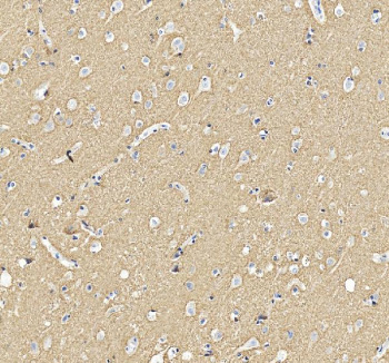 Immunohistochemical staining of SNCA using anti-SNCA antibody. SNCA was detected in a paraffin-embedded section of human brain tissue. Heat mediated antigen retrieval was performed in EDTA buffer (pH 8.0, epitope retrieval solution). The tissue section was blocked with 10% goat serum. The tissue section was then incubated with 2 ug/ml rabbit anti-SNCA antibody overnight at 4oC. Peroxidase Conjugated Goat Anti-rabbit IgG was used as secondary antibody and incubated for 30 minutes at 37oC. The tissue section was developed using an HRP secondary and DAB substrate.