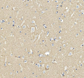 Immunohistochemical staining of SNCA using anti-SNCA antibody. SNCA was detected in a paraffin-embedded section of human brain tissue. Heat mediated antigen retrieval was performed in EDTA buffer (pH 8.0, epitope retrieval solution). The tissue section was blocked with 10% goat serum. The tissue section was then incubated with 2 ug/ml rabbit anti-SNCA antibody overnight at 4oC. Peroxidase Conjugated Goat Anti-rabbit IgG was used as secondary antibody and incubated for 30 minutes at 37oC. The tissue section was developed using an HRP secondary and DAB substrate.