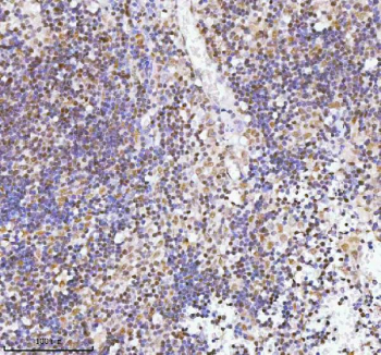 Immunohistochemical staining of RBM42 using anti-RBM42 antibody. RBM42 was detected in a paraffin-embedded section of human spleen tissue. Heat mediated antigen retrieval was performed in EDTA buffer (pH 8.0, epitope retrieval solution). The tissue section was blocked with 10% goat serum. The tissue section was then incubated with 2 ug/ml rabbit anti-RBM42 antibody overnight at 4oC. Peroxidase Conjugated Goat Anti-rabbit IgG was used as secondary antibody and incubated for 30 minutes at 37oC. The tissue section was developed using an HRP secondary and DAB substrate.
