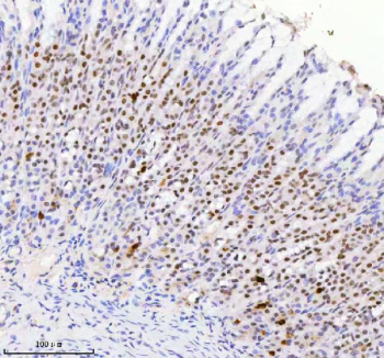 Immunohistochemical staining of RBM42 using anti-RBM42 antibody. RBM42 was detected in a paraffin-embedded section of rat stomach tissue. Heat mediated antigen retrieval was performed in EDTA buffer (pH 8.0, epitope retrieval solution). The tissue section was blocked with 10% goat serum. The tissue section was then incubated with 2 ug/ml rabbit anti-RBM42 antibody overnight at 4oC. Peroxidase Conjugated Goat Anti-rabbit IgG was used as secondary antibody and incubated for 30 minutes at 37oC. The tissue section was developed using an HRP secondary and DAB substrate.