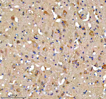 Immunohistochemical staining of FUNDC1 using anti-FUNDC1 antibody. FUNDC1 was detected in a paraffin-embedded section of mouse midbrain tissue. Heat mediated antigen retrieval was performed in EDTA buffer (pH 8.0, epitope retrieval solution). The tissue section was blocked with 10% goat serum. The tissue section was then incubated with 2 ug/ml rabbit anti-FUNDC1 antibody overnight at 4oC. Peroxidase Conjugated Goat Anti-rabbit IgG was used as secondary antibody and incubated for 30 minutes at 37oC. The tissue section was developed using an HRP secondary and DAB substrate.