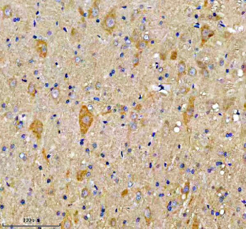 Immunohistochemical staining of FUNDC1 using anti-FUNDC1 antibody. FUNDC1 was detected in a paraffin-embedded section of rat midbrain tissue. Heat mediated antigen retrieval was performed in EDTA buffer (pH 8.0, epitope retrieval solution). The tissue section was blocked with 10% goat serum. The tissue section was then incubated with 2 ug/ml rabbit anti-FUNDC1 antibody overnight at 4oC. Peroxidase Conjugated Goat Anti-rabbit IgG was used as secondary antibody and incubated for 30 minutes at 37oC. The tissue section was developed using an HRP secondary and DAB substrate.