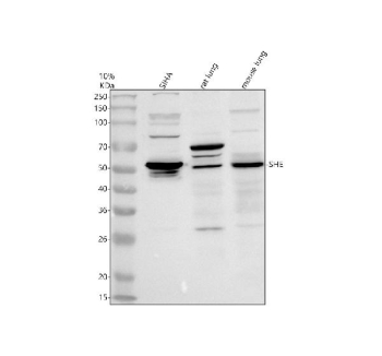 Western blot analysis of SHE using anti-SHE antibody. Electrophoresis was performed on a 10% SDS-PAGE gel at 80V (Stacking gel) / 120V (Resolving gel) for 2 hours. Lane 1: human SIHA whole cell lysates, Lane 2: rat lung tissue lysates, Lane 3: mouse lung tissue lysates. After electrophoresis, proteins were transferred to a nitrocellulose membrane at 150 mA for 50-90 minutes. Blocked the membrane with 5% non-fat milk/TBS for 1.5 hour at RT. The membrane was incubated with rabbit anti-SHE antibody at 0.5 ug/ml overnight at 4oC, then washed with TBS-0.1%Tween 3 times with 5 minutes each and probed with a goat anti-rabbit IgG-HRP secondary antibody at a dilution of 1:5000 for 1.5 hour at RT. The signal was developed using an ECL Plus Western Blotting Substrate. A specific band was detected for SHE at approximately 54 kDa. The expected molecular weight of SHE is ~54 kDa.