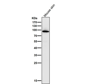 MPO Antibody for WB / Myeloperoxidase Western Blot Antibody (clone 32M13). Western blot analysis of mouse skin lysate using MPO antibody for WB (clone 32M13) at 1:1000 dilution for 1 hour at room temperature. A prominent band is detected at approximately 70-75 kDa, consistent with the predicted molecular weight of the Myeloperoxidase / MPO alpha chain. The observed band may migrate slightly higher depending on glycosylation state, which is common for MPO due to post-translational modification of the enzyme in granulocytic cells.