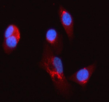 Immunofluorescent staining of SYCN using anti-SYCN antibody (red). SYCN was detected in an immunocytochemical section of PC-3 cells. Enzyme antigen retrieval was performed using IHC enzyme antigen retrieval reagent for 15 mins. The cells were blocked with 10% goat serum. And then incubated with 5 ug/ml rabbit anti-SYCN antibody overnight at 4oC. Cy3 Conjugated Goat Anti-Rabbit IgG was used as secondary antibody at 1:500 dilution and incubated for 30 minutes at 37oC. The section was counterstained with DAPI nuclear stain (blue). Visualize using a fluorescence microscope and filter sets appropriate for the label used.