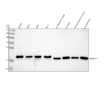 Western blot analysis of NDUFB11 using anti-NDUFB11 antibody. Electrophoresis was performed on a 12% SDS-PAGE gel at 80V (Stacking gel) / 120V (Resolving gel) for 2 hours. Lane 1: human HepG2 whole cell lysates, Lane 2: human 293T whole cell lysates, Lane 3: human Hela whole cell lysates, Lane 4: human PC-3 whole cell lysates, Lane 5: rat skeletal muscle tissue lysates, Lane 6: rat heart tissue lysates, Lane 7: mouse skeletal muscle tissue lysates, Lane 8: mouse heart tissue lysates. After electrophoresis, proteins were transferred to a nitrocellulose membrane at 150 mA for 50-90 minutes. Blocked the membrane with 5% non-fat milk/TBS for 1.5 hour at RT. The membrane was incubated with rabbit anti-NDUFB11 antibody at 1:1000 overnight at 4oC, then washed with TBS-0.1%Tween 3 times with 5 minutes each and probed with a goat anti-rabbit IgG-HRP secondary antibody at a dilution of 1:5000 for 1.5 hour at RT. The signal was developed using an ECL Plus Western Blotting Substrate. The expected molecular weight of NDUFB11 is ~18 kDa.