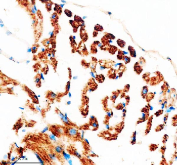 Immunohistochemical staining of NDUFB11 using anti-NDUFB11 antibody. NDUFB11 was detected in a paraffin-embedded section of mouse heart tissue. Heat mediated antigen retrieval was performed in EDTA buffer (pH 8.0, epitope retrieval solution). The tissue section was blocked with 10% goat serum. The tissue section was then incubated with 2 ug/ml rabbit anti-NDUFB11 antibody overnight at 4oC. Peroxidase Conjugated Goat Anti-rabbit IgG was used as secondary antibody and incubated for 30 minutes at 37oC. The tissue section was developed using an HRP secondary and DAB substrate.