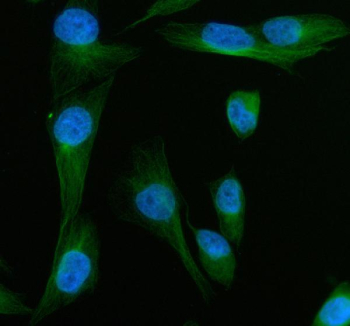 Immunofluorescent staining of MYOT using anti-MYOT antibody (green). MYOT was detected in an immunocytochemical section of GES-1 cells. Enzyme antigen retrieval was performed using IHC enzyme antigen retrieval reagent for 15 mins. The cells were blocked with 10% goat serum. And then incubated with 5 ug/ml rabbit anti-MYOT antibody overnight at 4oC. DyLight 488 Conjugated Goat Anti-Rabbit IgG was used as secondary antibody at 1:500 dilution and incubated for 30 minutes at 37oC. The section was counterstained with DAPI nuclear stain (blue). Visualize using a fluorescence microscope and filter sets appropriate for the label used.