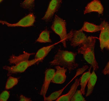 Immunofluorescent staining of OTUD4 using anti-OTUD4 antibody (green) and anti-Beta Tubulin antibody (red). OTUD4 was detected in an immunocytochemical section of Hela cells. Enzyme antigen retrieval was performed using IHC enzyme antigen retrieval reagent for 15 mins. The cells were blocked with 10% goat serum. And then incubated with 5 ug/ml rabbit anti-OTUD4 antibody and mouse anti-Beta Tubulin antibody overnight at 4oC. DyLight 488 Conjugated Goat Anti-Rabbit IgG and Cy3 Conjugated Goat Anti-Mouse IgG were used as secondary antibody at 1:500 dilution and incubated for 30 minutes at 37oC. Visualize using a fluorescence microscope and filter sets appropriate for the label used.