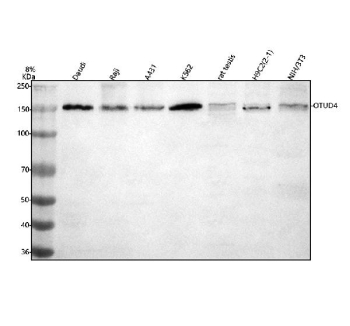 Western blot analysis of OTUD4 using anti-OTUD4 antibody. Electrophoresis was performed on a 8% SDS-PAGE gel at 80V (Stacking gel) / 120V (Resolving gel) for 2 hours. Lane 1: human Daudi whole cell lysates, Lane 2: human Raji whole cell lysates, Lane 3: human whole cell lysates, Lane 4: human K562 whole cell lysates, Lane 5: rat testis tissue lysates, Lane 6: rat H9C2(2-1) whole cell lysates, Lane 7: mouse NIH/3T3 whole cell lysates. After electrophoresis, proteins were transferred to a nitrocellulose membrane at 150 mA for 50-90 minutes. Blocked the membrane with 5% non-fat milk/TBS for 1.5 hour at RT. The membrane was incubated with rabbit anti-OTUD4 antibody at 0.5 ug/ml overnight at 4oC, then washed with TBS-0.1%Tween 3 times with 5 minutes each and probed with a goat anti-rabbit IgG-HRP secondary antibody at a dilution of 1:5000 for 1.5 hour at RT. The signal was developed using an ECL Plus Western Blotting Substrate. OTUD4 western blot across cell lines shows a predominant band at ~150 kDa. Although the theoretical mass is ~124 kDa, OTUD4 commonly migrates higher on SDS-PAGE due to extensive low-complexity regions and post-translational modifications, consistent with the observed band.