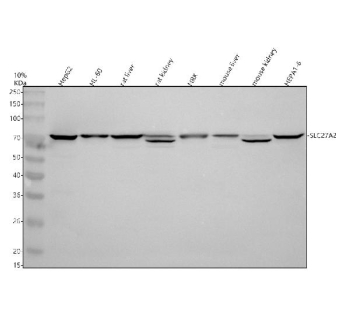 Western blot analysis of SLC27A2 using anti-SLC27A2 antibody. Electrophoresis was performed on a 10% SDS-PAGE gel at 80V (Stacking gel) / 120V (Resolving gel) for 2 hours. Lane 1: human HepG2 whole cell lysates, Lane 2: human HL-60 whole cell lysates, Lane 3: rat liver tissue lysates, Lane 4: rat kidney tissue lysates, Lane 5: rat NRK whole cell lysates, Lane 6: mouse liver tissue lysates Lane 7: mouse kidney tissue lysates, Lane 8: mouse HEPA1-6 whole cell lysates. After electrophoresis, proteins were transferred to a nitrocellulose membrane at 150 mA for 50-90 minutes. Blocked the membrane with 5% non-fat milk/TBS for 1.5 hour at RT. The membrane was incubated with rabbit anti-SLC27A2 antibody at 0.5 ug/ml overnight at 4oC, then washed with TBS-0.1%Tween 3 times with 5 minutes each and probed with a goat anti-rabbit IgG-HRP secondary antibody at a dilution of 1:5000 for 1.5 hour at RT. The signal was developed using an ECL Plus Western Blotting Substrate. SLC27A2 western blot across tissues shows the expected ~70 kDa band and a consistent lower band in mouse and rat kidney, consistent with co-expression of the FATP2a and FATP2b splice isoforms and minor PTM-dependent mobility differences.