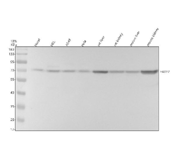 Western blot analysis of SLC27A2 using anti-SLC27A2 antibody. Electrophoresis was performed on a 10% SDS-PAGE gel at 80V (Stacking gel) / 120V (Resolving gel) for 2 hours. Lane 1: human Hacat whole cell lysates, Lane 2: human HEL whole cell lysates, Lane 3: human whole cell lysates, Lane 4: human Hela whole cell lysates, Lane 5: rat liver tissue lysates, Lane 6: rat kidney tissue lysates, Lane 7: mouse liver tissue lysates, Lane 8: mouse kidney tissue lysates. After electrophoresis, proteins were transferred to a nitrocellulose membrane at 150 mA for 50-90 minutes. Blocked the membrane with 5% non-fat milk/TBS for 1.5 hour at RT. The membrane was incubated with rabbit anti-SLC27A2 antibody at 1: 1000 overnight at 4oC, then washed with TBS-0.1%Tween 3 times with 5 minutes each and probed with a goat anti-rabbit IgG-HRP secondary antibody at a dilution of 1:5000 for 1.5 hour at RT. The signal was developed using an ECL Plus Western Blotting Substrate. A specific band was detected for SLC27A2 at approximately 70 kDa. The expected molecular weight of SLC27A2 is ~70 kDa.