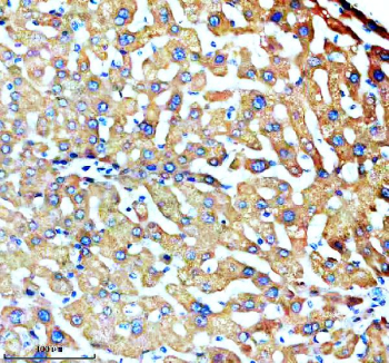 Immunohistochemical staining of SLC27A2 using anti-SLC27A2 antibody. SLC27A2 was detected in a paraffin-embedded section of human liver tissue. Heat mediated antigen retrieval was performed in EDTA buffer (pH 8.0, epitope retrieval solution). The tissue section was blocked with 10% goat serum. The tissue section was then incubated with 2 ug/ml rabbit anti-SLC27A2 antibody overnight at 4oC. Peroxidase Conjugated Goat Anti-rabbit IgG was used as secondary antibody and incubated for 30 minutes at 37oC. The tissue section was developed using an HRP secondary and DAB substrate.