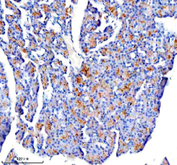 Immunohistochemical staining of CTRC using anti-CTRC antibody. CTRC was detected in a paraffin-embedded section of rat pancreas tissue. Heat mediated antigen retrieval was performed in EDTA buffer (pH 8.0, epitope retrieval solution). The tissue section was blocked with 10% goat serum. The tissue section was then incubated with 2 ug/ml rabbit anti-CTRC antibody overnight at 4oC. Peroxidase Conjugated Goat Anti-rabbit IgG was used as secondary antibody and incubated for 30 minutes at 37oC. The tissue section was developed using an HRP secondary and DAB substrate.