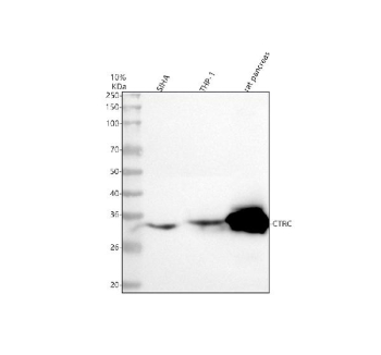 Western blot analysis of CTRC using anti-CTRC antibody. Lane 1: human SiHa whole cell lysates, Lane 2: human THP-1 whole cell lysates, Lane 3: rat pancreas tissue lysates. After electrophoresis, proteins were transferred to a nitrocellulose membrane at 150 mA for 50-90 minutes. Blocked the membrane with 5% non-fat milk/TBS for 1.5 hour at RT. The membrane was incubated with rabbit anti-CTRC antibody at 0.5 ug/ml overnight at 4oC, then washed with TBS-0.1%Tween 3 times with 5 minutes each and probed with a goat anti-rabbit IgG-HRP secondary antibody at a dilution of 1:5000 for 1.5 hour at RT. The signal was developed using enhanced chemiluminescent. CTRC western blot shows a predominant band at ~34 kDa, consistent with glycosylated chymotrypsin C migrating above its predicted ~29 kDa.