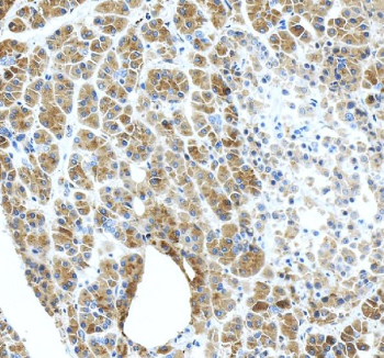 Immunohistochemical staining of CTRC using anti-CTRC antibody. CTRC was detected in a paraffin-embedded section of human pancreas tissue. Heat mediated antigen retrieval was performed in EDTA buffer (pH 8.0, epitope retrieval solution). The tissue section was blocked with 10% goat serum. The tissue section was then incubated with 2 ug/ml rabbit anti-CTRC antibody overnight at 4oC. Peroxidase Conjugated Goat Anti-rabbit IgG was used as secondary antibody and incubated for 30 minutes at 37oC. The tissue section was developed using an HRP secondary and DAB substrate.