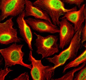 Immunofluorescent staining of SIPA1 using anti-SIPA1 antibody (green) and anti-Beta Tubulin antibody (red). SIPA1 was detected in an immunocytochemical section of U2OS cells. Enzyme antigen retrieval was performed using IHC enzyme antigen retrieval reagent for 15 mins. The cells were blocked with 10% goat serum. And then incubated with 5 ug/ml rabbit anti-SIPA1 antibody and mouse anti-Beta Tubulin antibody overnight at 4oC. DyLight 488 Conjugated Goat Anti-Rabbit IgG and Cy3 Conjugated Goat Anti-Mouse IgG were used as secondary antibody at 1:500 dilution and incubated for 30 minutes at 37oC. Visualize using a fluorescence microscope and filter sets appropriate for the label used.
