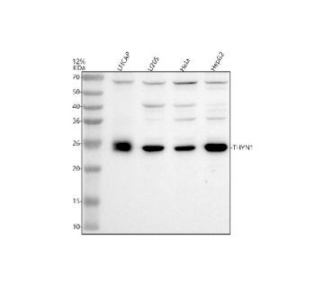 Western blot analysis of THYN1 using anti-THYN1 antibody. Electrophoresis was performed on a 12% SDS-PAGE gel at 80V (Stacking gel) / 120V (Resolving gel) for 2 hours. Lane 1: human LNCAP whole cell lysates, Lane 2: human U2OS whole cell lysates, Lane 3: human Hela whole cell lysates, Lane 4: human HepG2 whole cell lysates. After electrophoresis, proteins were transferred to a nitrocellulose membrane at 150 mA for 50-90 minutes. Blocked the membrane with 5% non-fat milk/TBS for 1.5 hour at RT. The membrane was incubated with rabbit anti-THYN1 antibody at 0.5 ug/ml overnight at 4oC, then washed with TBS-0.1%Tween 3 times with 5 minutes each and probed with a goat anti-rabbit IgG-HRP secondary antibody at a dilution of 1:5000 for 1.5 hour at RT. The signal was developed using an ECL Plus Western Blotting Substrate. A specific band was detected for THYN1 at approximately 26 kDa. The expected molecular weight of THYN1 is ~26 kDa.