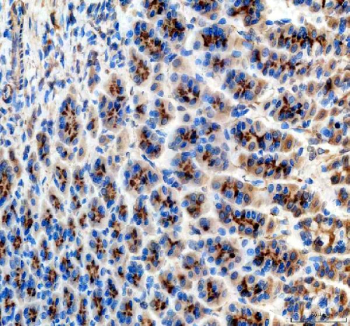 Immunohistochemical staining of ABCG5 using anti-ABCG5 antibody. ABCG5 was detected in a paraffin-embedded section of mouse stomach tissue. Heat mediated antigen retrieval was performed in EDTA buffer (pH 8.0, epitope retrieval solution). The tissue section was blocked with 10% goat serum. The tissue section was then incubated with 2 ug/ml rabbit anti-ABCG5 antibody overnight at 4oC. Peroxidase Conjugated Goat Anti-rabbit IgG was used as secondary antibody and incubated for 30 minutes at 37oC. The tissue section was developed using an HRP secondary and DAB substrate.