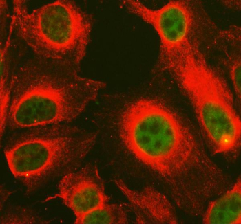 Immunofluorescent staining of NUPR1 using anti-NUPR1 antibody (green) and anti-Beta Tubulin antibody (red). NUPR1 was detected in an immunocytochemical section of U2OS cells. Enzyme antigen retrieval was performed using IHC enzyme antigen retrieval reagent for 15 mins. The cells were blocked with 10% goat serum. And then incubated with 5 ug/ml rabbit anti-NUPR1 antibody and mouse anti-Beta Tubulin antibody overnight at 4oC. DyLight 488 Conjugated Goat Anti-Rabbit IgG and Cy3 Conjugated Goat Anti-Mouse IgG were used as secondary antibody at 1:500 dilution and incubated for 30 minutes at 37oC. Visualize using a fluorescence microscope and filter sets appropriate for the label used.