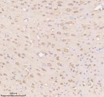 Immunohistochemical staining of TIMM9 using anti-TIMM9 antibody. TIMM9 was detected in a paraffin-embedded section of rat brain tissue. Heat mediated antigen retrieval was performed in EDTA buffer (pH 8.0, epitope retrieval solution). The tissue section was blocked with 10% goat serum. The tissue section was then incubated with 2 ug/ml rabbit anti-TIMM9 antibody overnight at 4oC. Peroxidase Conjugated Goat Anti-rabbit IgG was used as secondary antibody and incubated for 30 minutes at 37oC. The tissue section was developed using an HRP secondary and DAB substrate.
