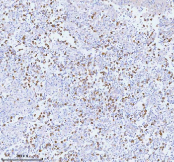 Immunohistochemical staining of PCYOX1 using anti-PCYOX1 antibody. PCYOX1 was detected in a paraffin-embedded section of human testicular seminoma tissue. Heat mediated antigen retrieval was performed in EDTA buffer (pH 8.0, epitope retrieval solution). The tissue section was blocked with 10% goat serum. The tissue section was then incubated with 2 ug/ml rabbit anti-PCYOX1 antibody overnight at 4oC. Peroxidase Conjugated Goat Anti-rabbit IgG was used as secondary antibody and incubated for 30 minutes at 37oC. The tissue section was developed using an HRP secondary and DAB substrate.