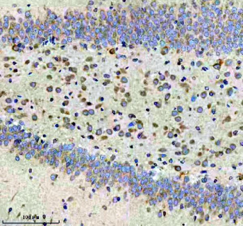 Immunohistochemical staining of CBR1 using anti-CBR1 antibody. CBR1 was detected in a paraffin-embedded section of rat brain tissue. Heat mediated antigen retrieval was performed in EDTA buffer (pH 8.0, epitope retrieval solution). The tissue section was blocked with 10% goat serum. The tissue section was then incubated with 1:50 rabbit anti-CBR1 antibody overnight at 4oC. Peroxidase Conjugated Goat Anti-rabbit IgG was used as secondary antibody and incubated for 30 minutes at 37oC. The tissue section was developed using an HRP secondary and DAB substrate.