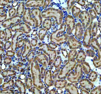 Immunohistochemical staining of CBR1 using anti-CBR1 antibody. CBR1 was detected in a paraffin-embedded section of rat kidney tissue. Heat mediated antigen retrieval was performed in EDTA buffer (pH 8.0, epitope retrieval solution). The tissue section was blocked with 10% goat serum. The tissue section was then incubated with 1:50 rabbit anti-CBR1 antibody overnight at 4oC. Peroxidase Conjugated Goat Anti-rabbit IgG was used as secondary antibody and incubated for 30 minutes at 37oC. The tissue section was developed using an HRP secondary and DAB substrate.