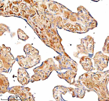 Immunohistochemical staining of SERPING1/C1 using anti-C1 Inhibitor (C1-INH) antibody. SERPING1/C1 was detected in a paraffin-embedded section of human placenta tissue. Heat mediated antigen retrieval was performed in EDTA buffer (pH 8.0, epitope retrieval solution). The tissue section was blocked with 10% goat serum. The tissue section was then incubated with 1:100 rabbit anti-C1 Inhibitor (C1-INH) antibody overnight at 4oC. Peroxidase Conjugated Goat Anti-rabbit IgG was used as secondary antibody and incubated for 30 minutes at 37oC. The tissue section was developed using an HRP secondary and DAB substrate.