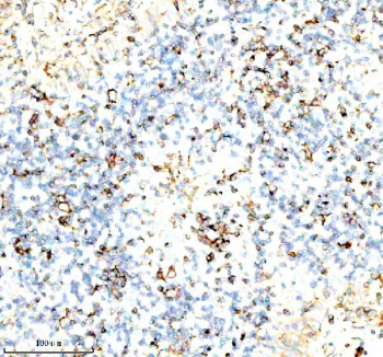 Immunohistochemical staining of SERPING1/C1 using anti-C1 Inhibitor (C1-INH) antibody. SERPING1/C1 was detected in a paraffin-embedded section of human spleen tissue. Heat mediated antigen retrieval was performed in EDTA buffer (pH 8.0, epitope retrieval solution). The tissue section was blocked with 10% goat serum. The tissue section was then incubated with 1:100 rabbit anti-C1 Inhibitor (C1-INH) antibody overnight at 4oC. Peroxidase Conjugated Goat Anti-rabbit IgG was used as secondary antibody and incubated for 30 minutes at 37oC. The tissue section was developed using an HRP secondary and DAB substrate.