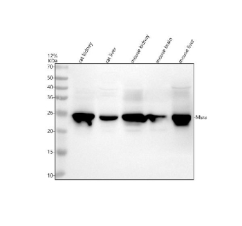 Western blot analysis of MSRA using anti-MSRA antibody. Electrophoresis was performed on a 12% SDS-PAGE gel at 80V (Stacking gel) / 120V (Resolving gel) for 2 hours. Lane 1: rat kidney tissue lysates, Lane 2: rat liver tissue lysates, Lane 3: mouse kidney tissue lysates, Lane 4: mouse brain tissue lysates, Lane 5: mouse liver tissue lysates. After electrophoresis, proteins were transferred to a nitrocellulose membrane at 150 mA for 50-90 minutes. Blocked the membrane with 5% non-fat milk/TBS for 1.5 hour at RT. The membrane was incubated with rabbit anti-MSRA antibody at 0.5 ug/ml overnight at 4oC, then washed with TBS-0.1%Tween 3 times with 5 minutes each and probed with a goat anti-rabbit IgG-HRP secondary antibody at a dilution of 1:5000 for 1.5 hour at RT. The signal was developed using an ECL Plus Western Blotting Substrate. The expected molecular weight of MSRA is ~26 kDa.