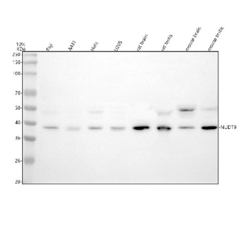 Western blot analysis of NUDT9 using anti-NUDT9 antibody. Lane 1: human Raji whole cell lysates, Lane 2: human whole cell lysates, Lane 3: human Hela whole cell lysates, Lane 4: human U20S whole cell lysates, Lane 5: rat brain tissue lysates, Lane 6: rat testis tissue lysates, Lane 7: mouse brain tissue lysates, Lane 8: mouse testis tissue lysates. After electrophoresis, proteins were transferred to a nitrocellulose membrane at 150 mA for 50-90 minutes. Blocked the membrane with 5% non-fat milk/TBS for 1.5 hour at RT. The membrane was incubated with rabbit anti-NUDT9 antibody at 0.5 ug/ml overnight at 4oC, then washed with TBS-0.1%Tween 3 times with 5 minutes each and probed with a goat anti-rabbit IgG-HRP secondary antibody at a dilution of 1:5000 for 1.5 hour at RT. The signal was developed using enhanced chemiluminescent. A specific band was detected for NUDT9 at approximately 39 kDa. The expected molecular weight of NUDT9 is ~39 kDa.