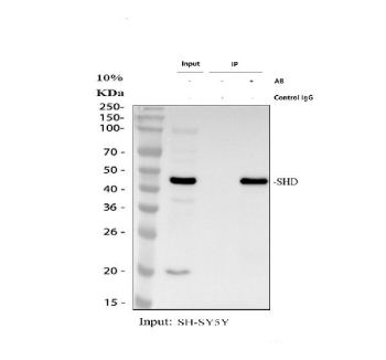 Immunoprecipitation and western blot analysis of SHD expression. SH-SY5Y whole cell lysates were used for immunoprecipitation with anti-SHD antibody. Lane 1 shows input SH-SY5Y whole cell lysate (30 ug). Lane 2 shows immunoprecipitation performed using rabbit control IgG instead of the primary antibody, serving as a negative control. Lane 3 shows immunoprecipitation using anti-SHD antibody incubated with SH-SY5Y whole cell lysate (500 ug). Immunoprecipitated proteins were resolved by SDS-PAGE, transferred to membrane, and detected using anti-SHD antibody followed by an HRP-conjugated goat anti-rabbit IgG light chain secondary antibody. A specific band corresponding to SHD is detected at approximately 40-50 kDa, consistent with the expected molecular weight of SHD.