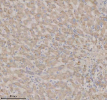 Immunohistochemical staining of SHD using anti-SHD antibody. SHD was detected in a paraffin-embedded section of human liver tissue. Heat mediated antigen retrieval was performed in EDTA buffer (pH 8.0, epitope retrieval solution). The tissue section was blocked with 10% goat serum. The tissue section was then incubated with 2 ug/ml rabbit anti-SHD antibody overnight at 4oC. Peroxidase Conjugated Goat Anti-rabbit IgG was used as secondary antibody and incubated for 30 minutes at 37oC. The tissue section was developed using an HRP secondary and DAB substrate.