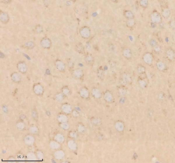 Immunohistochemical staining of SHD using anti-SHD antibody. SHD was detected in a paraffin-embedded section of mouse brain tissue. Heat mediated antigen retrieval was performed in EDTA buffer (pH 8.0, epitope retrieval solution). The tissue section was blocked with 10% goat serum. The tissue section was then incubated with 2 ug/ml rabbit anti-SHD antibody overnight at 4oC. Peroxidase Conjugated Goat Anti-rabbit IgG was used as secondary antibody and incubated for 30 minutes at 37oC. The tissue section was developed using an HRP secondary and DAB substrate.