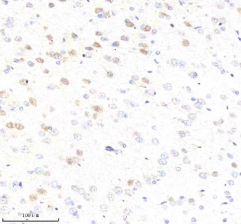 Immunohistochemical staining of ABCE1 using anti-ABCE1 antibody. ABCE1 was detected in a paraffin-embedded section of rat brain tissue. Heat mediated antigen retrieval was performed in EDTA buffer (pH 8.0, epitope retrieval solution). The tissue section was blocked with 10% goat serum. The tissue section was then incubated with 2 ug/ml rabbit anti-ABCE1 antibody overnight at 4oC. Peroxidase Conjugated Goat Anti-rabbit IgG was used as secondary antibody and incubated for 30 minutes at 37oC. The tissue section was developed using an HRP secondary and DAB substrate.