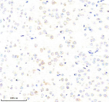 Immunohistochemical staining of ABCE1 using anti-ABCE1 antibody. ABCE1 was detected in a paraffin-embedded section of mouse brain tissue. Heat mediated antigen retrieval was performed in EDTA buffer (pH 8.0, epitope retrieval solution). The tissue section was blocked with 10% goat serum. The tissue section was then incubated with 2 ug/ml rabbit anti-ABCE1 antibody overnight at 4oC. Peroxidase Conjugated Goat Anti-rabbit IgG was used as secondary antibody and incubated for 30 minutes at 37oC. The tissue section was developed using an HRP secondary and DAB substrate.