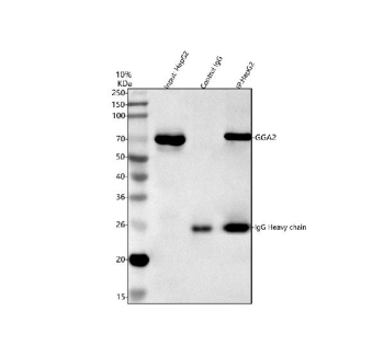 Immunoprecipitating GGA2 in HepG2 whole cell lysate. Western blot analysis of GGA2 using anti-GGA2 antibody; Lane 1: HepG2 whole cell lysates (30ug); Lane 2: Rabbit control IgG instead of anti-GGA2 antibody in HepG2 whole cell lysate; Lane 3: anti-GGA2 antibody (2ug) + HepG2 whole cell lysate (500ug). After electrophoresis, proteins were transferred to a membrane. Then the membrane was incubated with rabbit anti-GGA2 antibody at a dilution of 0.5 ug/ml and probed with a goat anti-rabbit IgG-HRP secondary antibody. The signal is developed using ECL Plus Western Blotting Substrate. The expected molecular weight of GGA2 is at 67 kDa.