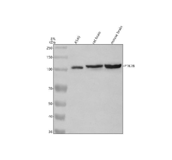 Western blot analysis of PYK2/PTK2B using anti-PTK2B antibody. Electrophoresis was performed on a 8% SDS-PAGE gel at 80V (Stacking gel) / 120V (Resolving gel) for 2 hours. Lane 1: human whole cell lysates, Lane 2: rat brain tissue lysates, Lane 3: mouse brain tissue lysates. After electrophoresis, proteins were transferred to a nitrocellulose membrane at 150 mA for 50-90 minutes. Blocked the membrane with 5% non-fat milk/TBS for 1.5 hour at RT. The membrane was incubated with rabbit anti-PTK2B antibody at 0.5 ug/ml overnight at 4oC, then washed with TBS-0.1%Tween 3 times with 5 minutes each and probed with a goat anti-rabbit IgG-HRP secondary antibody at a dilution of 1:5000 for 1.5 hour at RT. The signal was developed using an ECL Plus Western Blotting Substrate. A specific band was detected for PYK2/PTK2B at approximately 116 kDa. The expected molecular weight of PYK2/PTK2B is at 116 kDa.