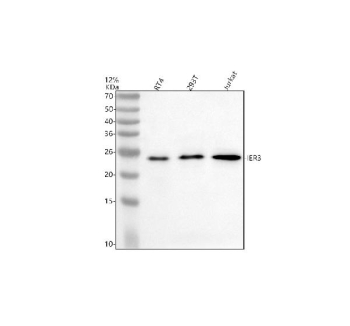 Western blot analysis of IER3 using anti-IER3 antibody. Electrophoresis was performed on a 12% SDS-PAGE gel at 80V (Stacking gel) / 120V (Resolving gel) for 2 hours. Lane 1: human RT4 whole cell lysates, Lane 2: human 293T whole cell lysates, Lane 3: human Jurkat whole cell lysates. After electrophoresis, proteins were transferred to a nitrocellulose membrane at 150 mA for 50-90 minutes. Blocked the membrane with 5% non-fat milk/TBS for 1.5 hour at RT. The membrane was incubated with rabbit anti-IER3 antibody at 0.5 ug/ml overnight at 4oC, then washed with TBS-0.1%Tween 3 times with 5 minutes each and probed with a goat anti-rabbit IgG-HRP secondary antibody at a dilution of 1:5000 for 1.5 hour at RT. The signal was developed using an ECL Plus Western Blotting Substrate. A band at ~23 kDa is detected across samples, running higher than the ~17 kDa prediction. The upward shift is consistent with the known anomalous migration of the acidic, serine-rich IER3 protein and phosphorylation-dependent mobility differences reported in cell stress conditions.