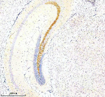Immunohistochemical staining of SLC7A14 using anti-SLC7A14 antibody. SLC7A14 was detected in a paraffin-embedded section of mouse brain tissue. Heat mediated antigen retrieval was performed in EDTA buffer (pH 8.0, epitope retrieval solution). The tissue section was blocked with 10% goat serum. The tissue section was then incubated with 2 ug/ml rabbit anti-SLC7A14 antibody overnight at 4oC. Peroxidase Conjugated Goat Anti-rabbit IgG was used as secondary antibody and incubated for 30 minutes at 37oC. The tissue section was developed using an HRP secondary and DAB substrate.